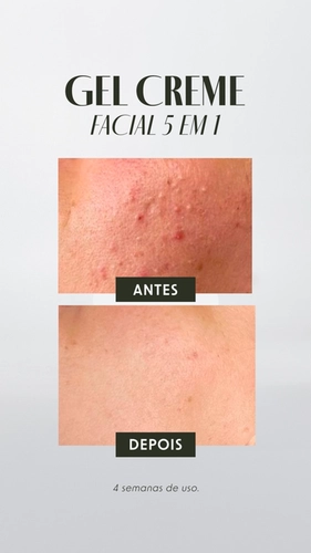 Gel-Creme Facial 5 em 1 MÉNER 50g